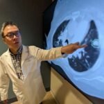 La IA conecta a los médicos para mapear tumores pulmonares y radioterapia