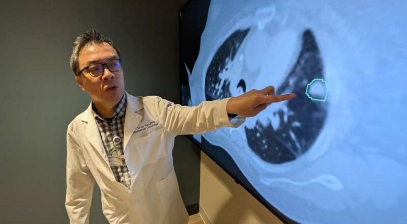 La IA conecta a los médicos para mapear tumores pulmonares y radioterapia