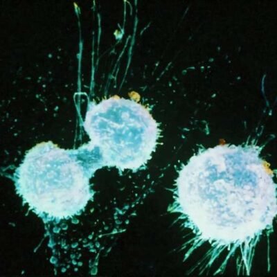 Un enfoque de medicina de precisión identifica un tratamiento prometedor para el cáncer de ovario