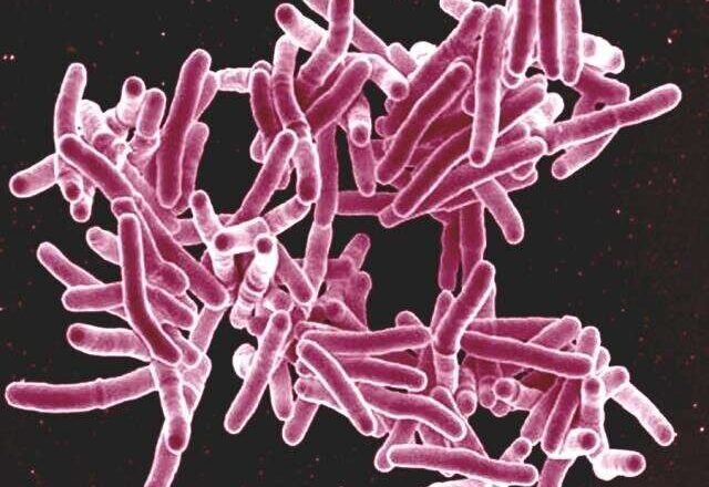 Los ensayos clínicos revelan alternativas prometedoras a un fármaco contra la tuberculosis de alta toxicidad