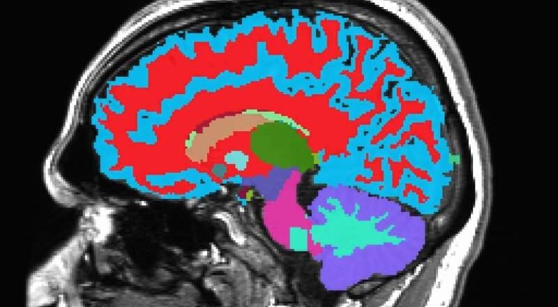 Un solo escáner cerebral puede determinar qué tan rápido estás envejeciendo
