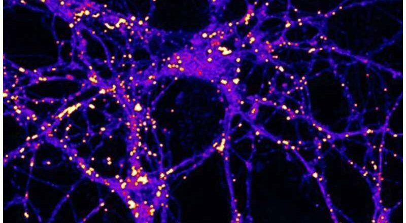 Los triglicéridos pueden desempeñar un papel importante en el metabolismo cerebral.