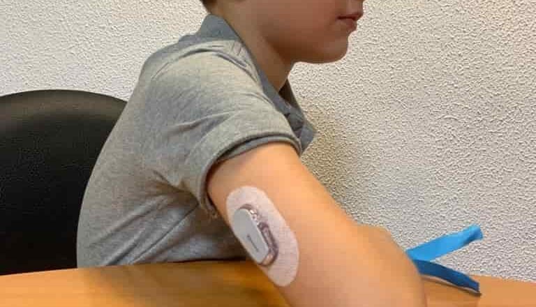 Diabetes tipo 1 en niños: hacia la era del páncreas artificial