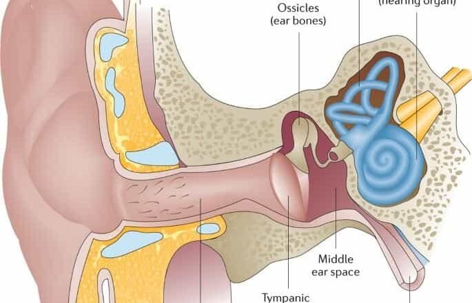 Otitis media crónica: desafíos diagnósticos y terapéuticos en otorrinolaringología