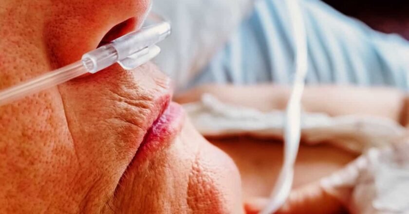 Fibrosis pulmonar idiopática: el reto silencioso de la neumología moderna
