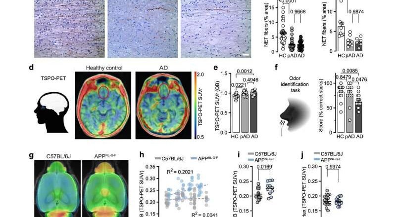 La respuesta inmune del cerebro está vinculada a problemas olfativos asociados al Alzheimer