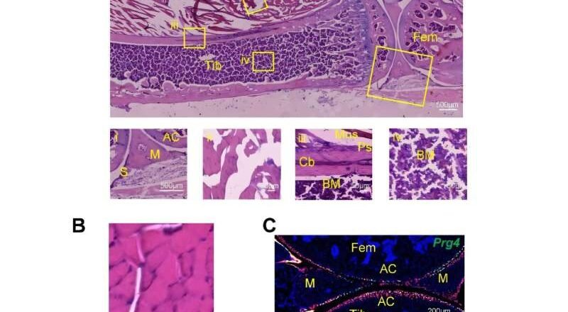 El descubrimiento de células madre podría ser clave para fracturas difíciles de curar
