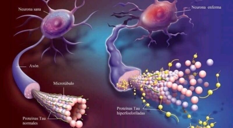 Anticuerpos anti-tau: la nueva frontera en la terapia del Alzheimer 🧠💉🔬