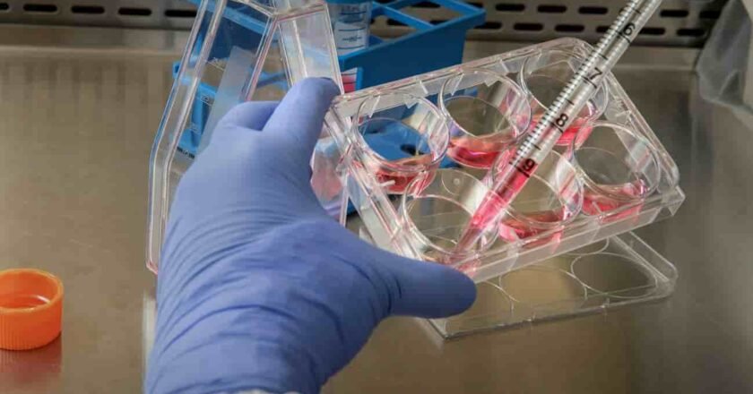 Desarrollan una terapia génica contra el sarcoma de Ewing, un tipo de cáncer infantil