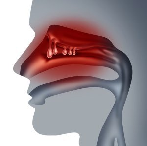 Pólipos nasales y asma: la nueva era de los biológicos en otorrinolaringología 👃💉