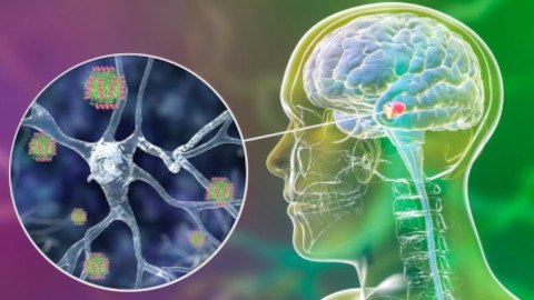 Terapias génicas en Parkinson: atacando la alfa-sinucleína y los genes de riesgo 🧠🧬💉