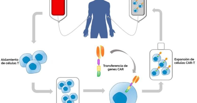 Terapias con células CAR-T más allá del cáncer: nuevas aplicaciones en enfermedades autoinmunes