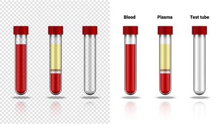 Del PET al pinchazo: cómo los tests de sangre están transformando el diagnóstico del Alzheimer 🧠🧪💉