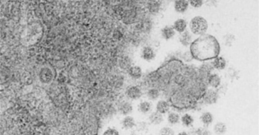 Una vacuna intranasal experimental elimina el virus de la covid-19 en ratones