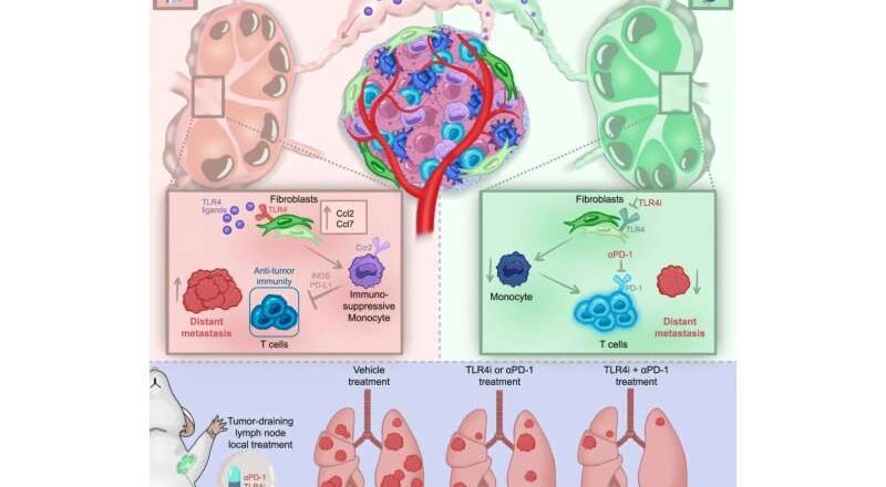 Un estudio de los ganglios linfáticos revela cómo el cáncer de mama agresivo evade la detección inmunitaria