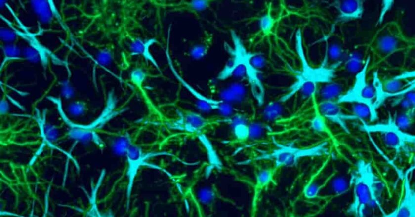La neurociencia del cáncer: descubren cómo crece el tumor cerebral más frecuente en niños