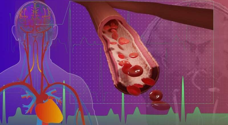 Un método de imágenes cerebrales revela cambios vasculares ocultos con el envejecimiento