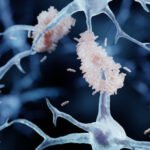 Reparar la barrera cerebral: ¿una nueva vía para frenar el alzheimer?