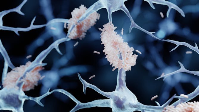 Reparar la barrera cerebral: ¿una nueva vía para frenar el alzheimer?