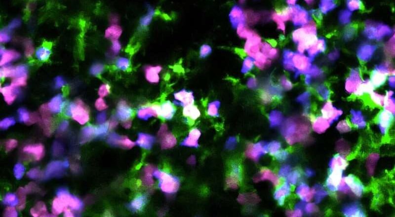 Cáncer de sangre: los científicos reprograman la muerte de las células cancerosas para activar el sistema inmunológico