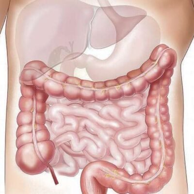El sangrado rectal en adultos jóvenes se relaciona con un riesgo 8,5 veces mayor de cáncer colorrectal