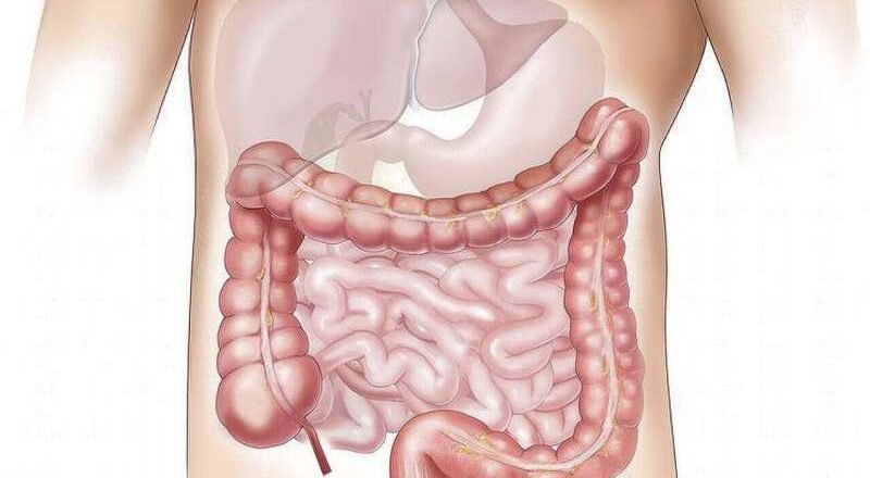 El sangrado rectal en adultos jóvenes se relaciona con un riesgo 8,5 veces mayor de cáncer colorrectal