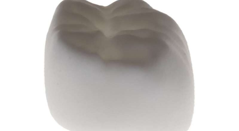 La joya de la corona de la tecnología de restauración dental podría estar a la vista con la impresión 3D