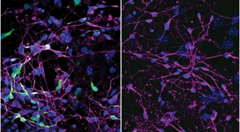 El descubrimiento de las vías de entrada viral y las moléculas señuelo podría bloquear la fiebre amarilla y la encefalitis.