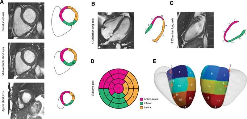 El primer mapeo genético 3D del corazón descubre genes implicados en la muerte súbita