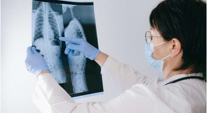 El uso selectivo de esteroides podría ofrecer un tratamiento complementario universal para combatir la tuberculosis