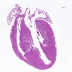 Una técnica precisa de edición genética cambia una base de ADN para corregir una enfermedad cardíaca