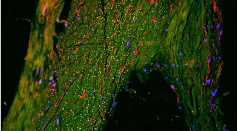 Un centro previamente desconocido en el sistema de drenaje linfático del cerebro podría ayudar a eliminar los desechos.