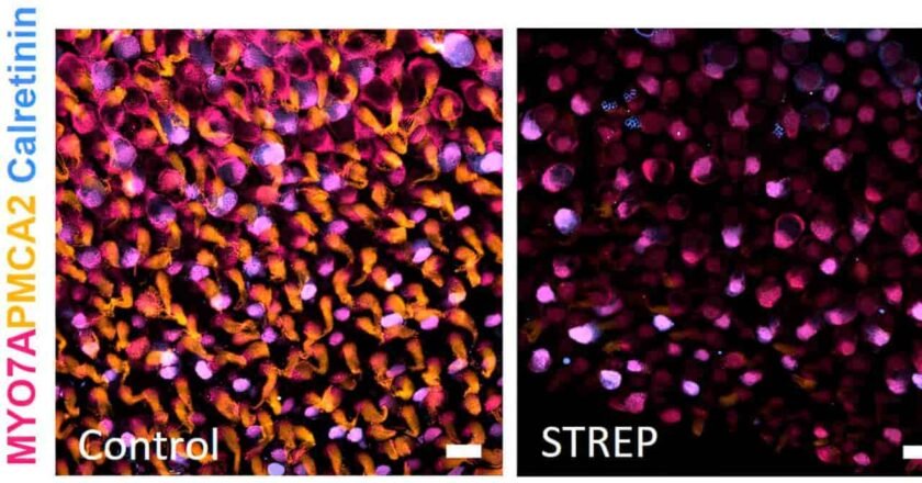 Los mecanismos genéticos revelan cómo las sustancias tóxicas dañan las células del equilibrio en el oído interno.