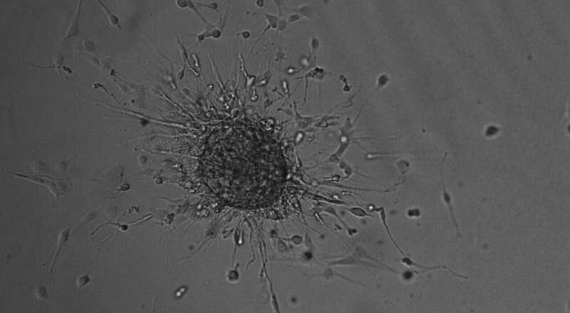 Un cóctel de microARN abre nuevas posibilidades contra los tumores cerebrales