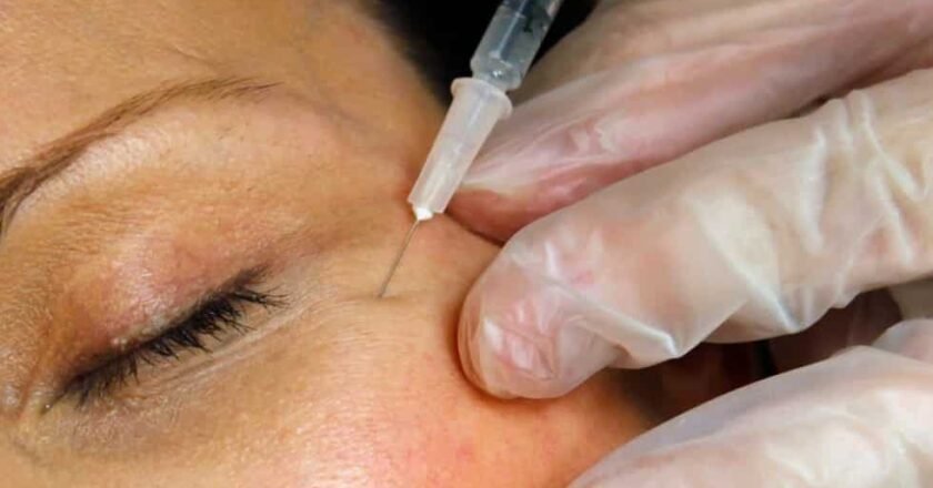 La FDA lanza advertencia contra la venta en línea de versiones falsas de Botox