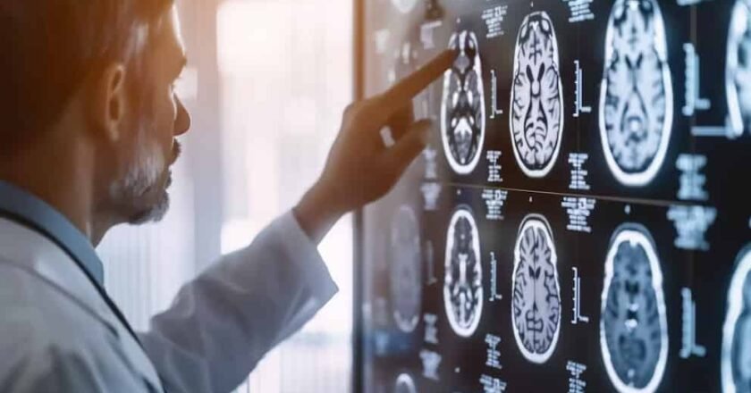 Un estudio reveló que ciertas bacterias en los tumores cerebrales pueden generar resistencia a la quimioterapia