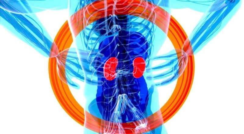 La enfermedad renal crónica es ahora la novena causa principal de muerte, según un análisis global.