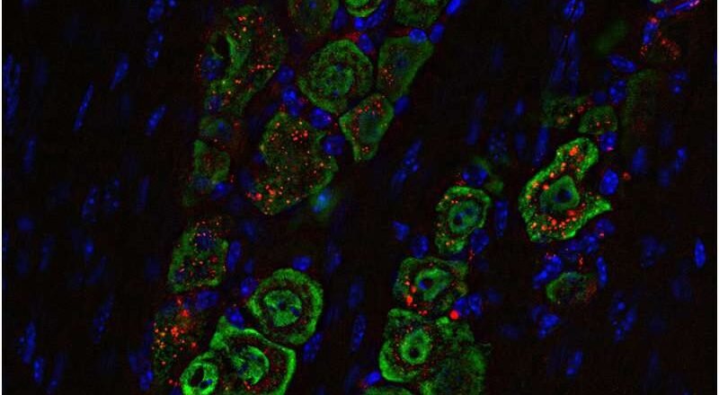 La nanomedicina nasal ofrece una terapia inmunoestimulante para combatir los tumores cerebrales