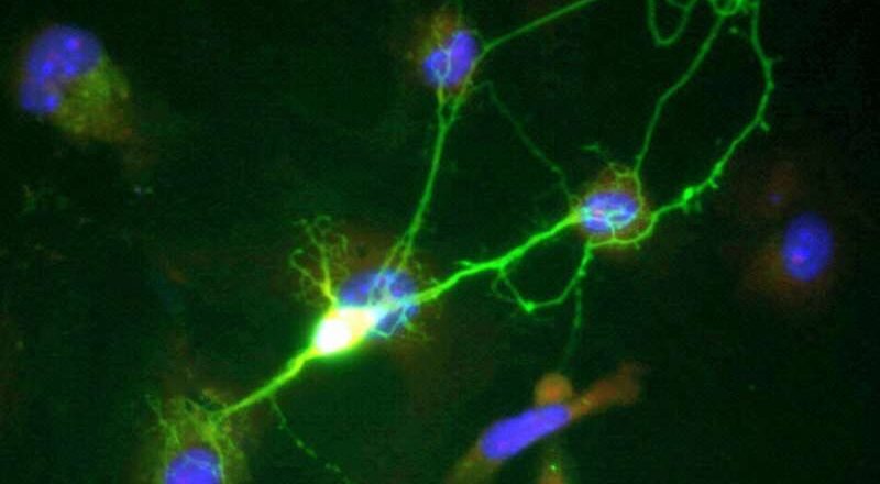 Un nuevo mecanismo de señalización neuronal abre el camino hacia tratamientos más seguros para el dolor