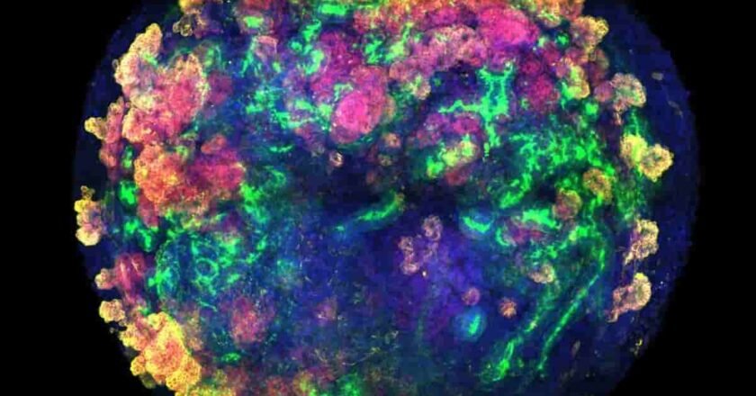 Primer trasplante exitoso de riñones porcinos modificados: un avance histórico hacia la medicina del futuro