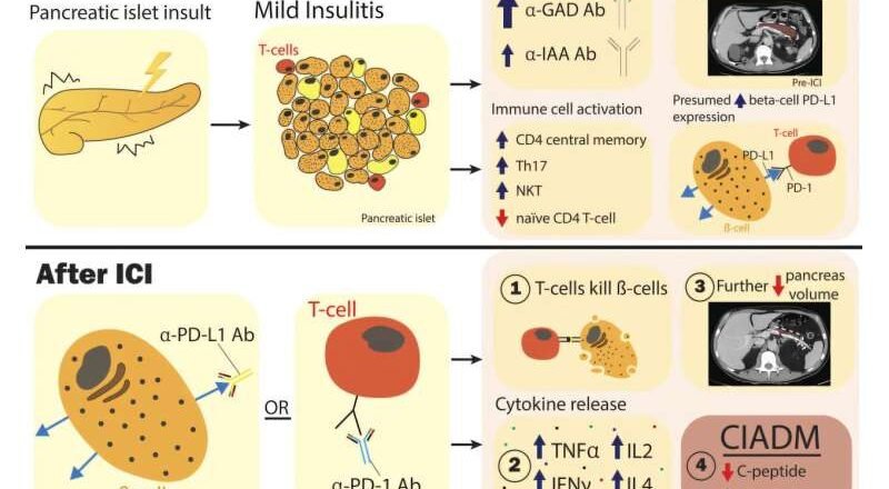 Nuevas señales biológicas permiten anticipar una rara complicación autoinmune en pacientes con cáncer