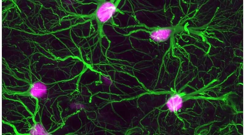 Un estudio identifica la fuente de radicales libres en el cerebro que podrían alimentar la demencia.