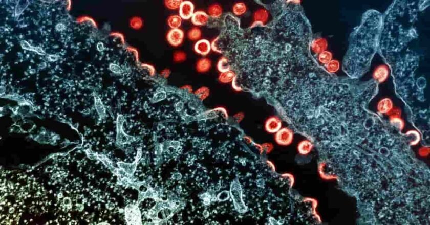 Cómo ciertos tratamientos experimentales están acercando la posibilidad de una “cura funcional” del VIH