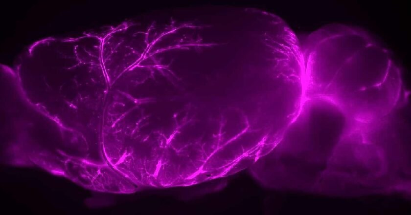 El “sistema de fontanería” del cerebro abre nuevas vías para tratar el Alzheimer