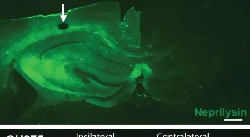 El descubrimiento de los receptores cerebrales podría abrir la puerta a nuevos tratamientos para el Alzheimer