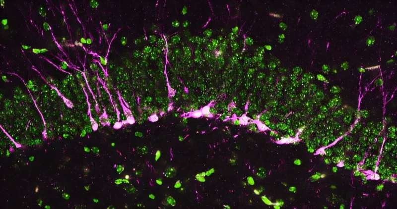 Una proteína que produce sulfuro de hidrógeno muestra potencial como objetivo terapéutico para la enfermedad de Alzheimer