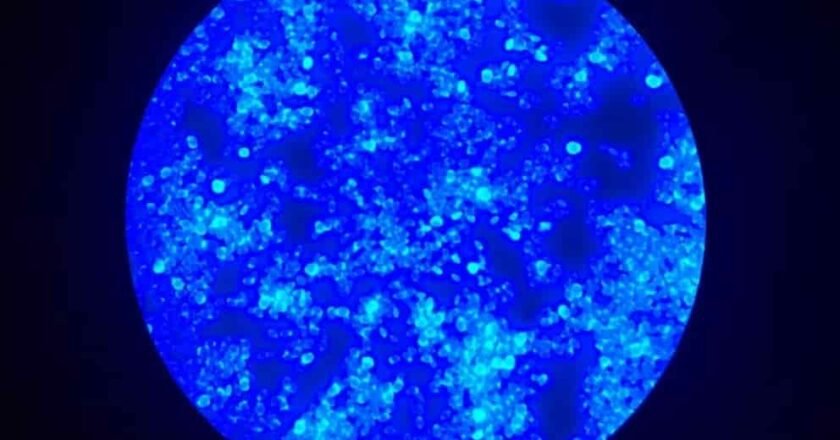 Un hongo silencioso en los hospitales: científicos identifican una posible vía para frenar a Candida auris