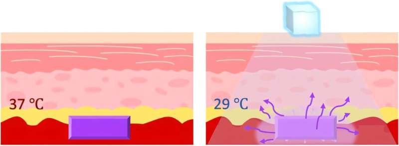 Un innovador dispositivo activado por enfriamiento promete transformar la administración de analgésicos