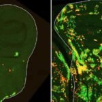 Científicos israelíes identifican el mecanismo que permite la regeneración del tejido tras un daño severo