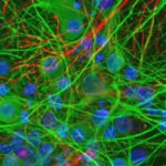 Desarrollan un recubrimiento que perfora bacterias al contacto y podría cambiar el control de infecciones hospitalarias